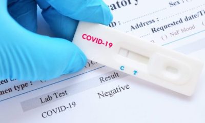 Chula COVID-19 Strip Test