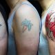 Tattoo removal, Remove Tattoo, Tattoo