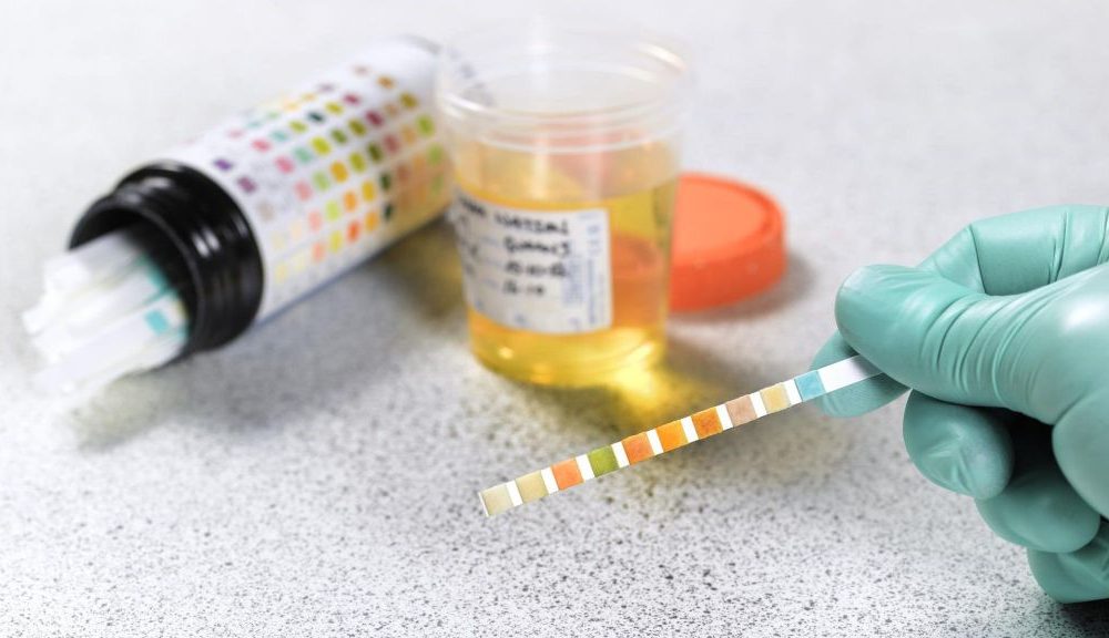 Fake Pee, What is Synthetic Urine and Why is it Being Used by People