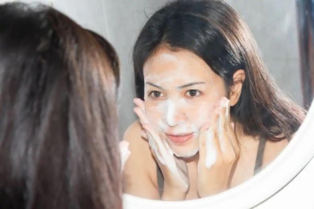 5 Reasons to Use Natural Products to Treat Acne Problems