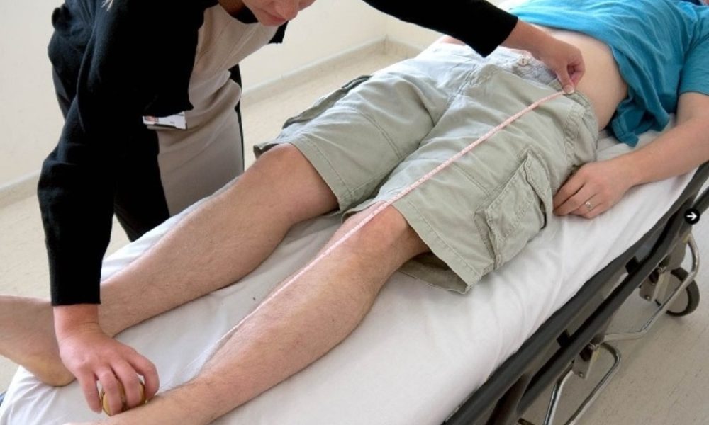 Understanding Limb Shortening Surgery and How its Improving Lives