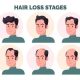 Hair Loss: How Do I Avoid Hair Fall at the Age Of Twenty?