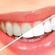 Teeth whitening