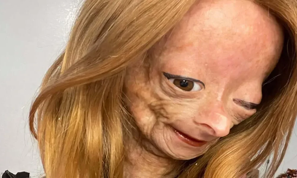 Adalia Rose