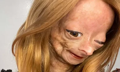 Adalia Rose