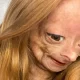 Adalia Rose