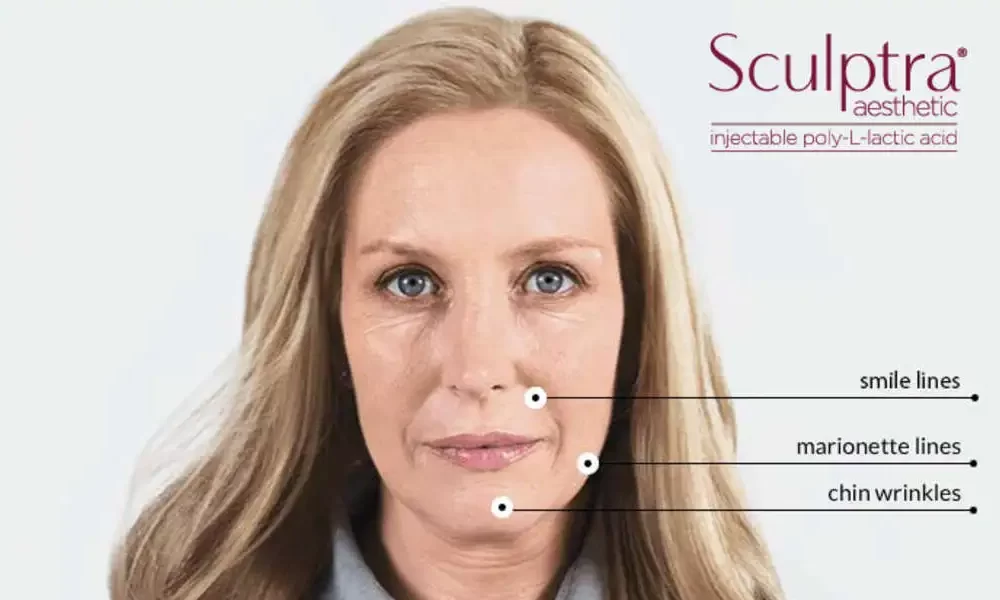 Sculptra
