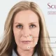 Sculptra