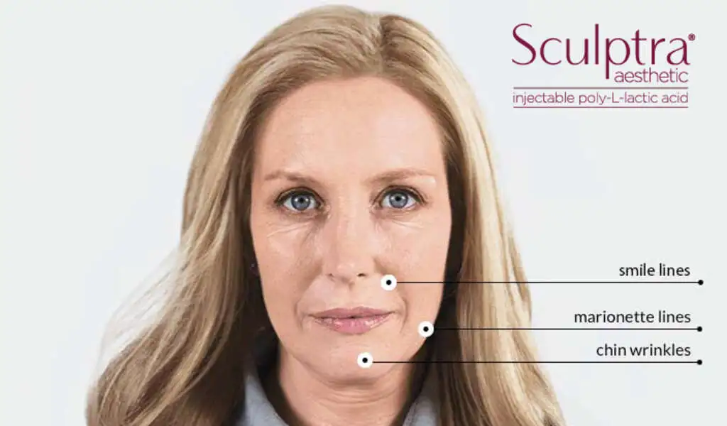 Sculptra