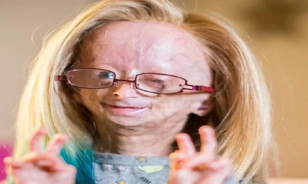 Adalia Rose