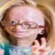 Adalia Rose