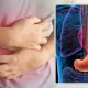 Stomach Cancer
