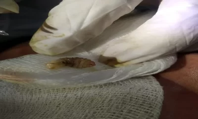 Botflies