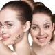 Trending Plastic Surgeries in 2022