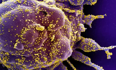 COVID-19: A Brief History And Treatments in Development