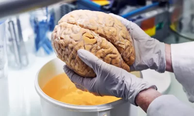 Even A Mild Case Of COVID-19 Can Cause Your Brain To Shrink