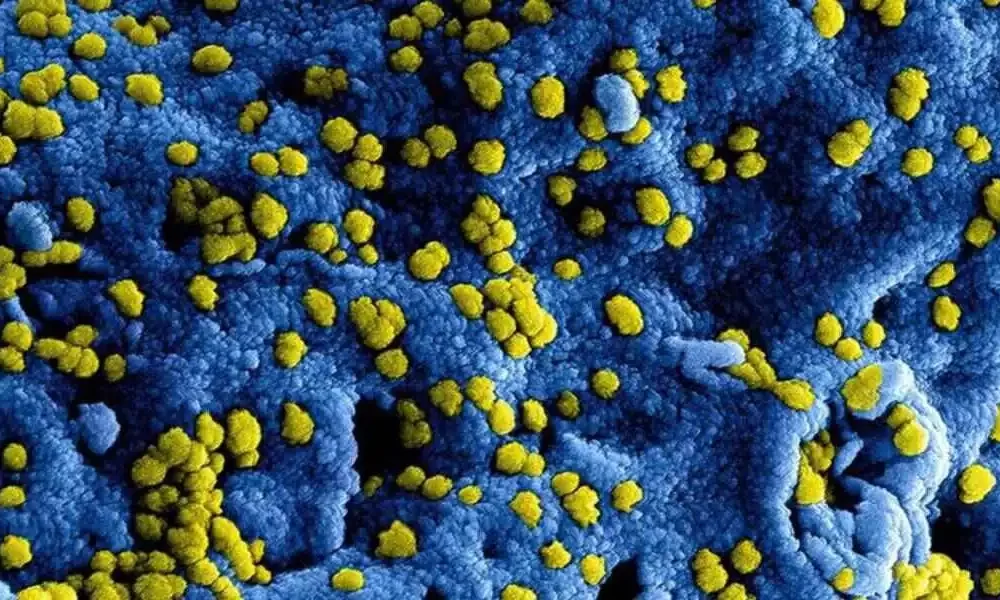 Kashmir Virologist Discovers Recent Outbreak Of Rift Valley Fever in Humans