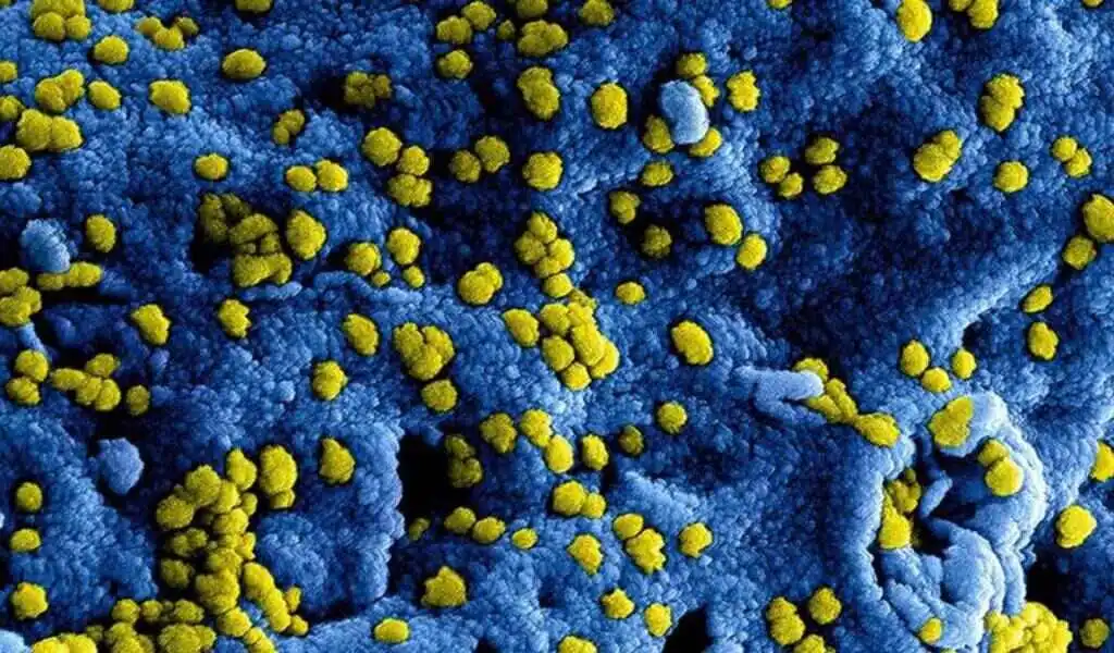 Kashmir Virologist Discovers Recent Outbreak Of Rift Valley Fever in Humans