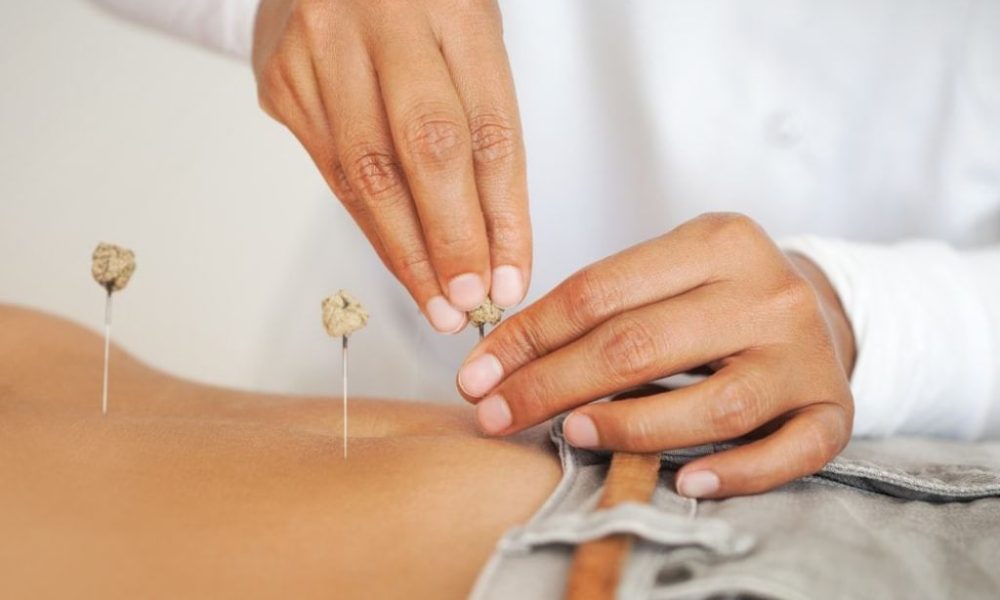 Learn How Can Acupuncture Help You Get Pregnant