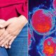 4 Important Things You Need to Know About STDs