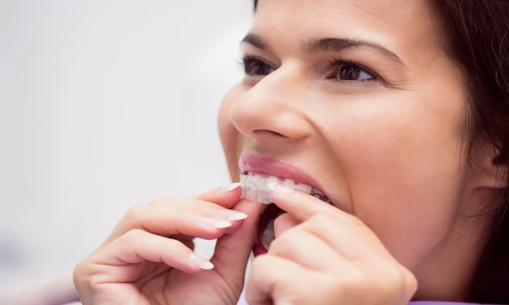 Adults With Invisible Braces