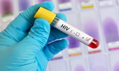 HIV Testing - Here's What You Need To Know
