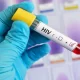 HIV Testing - Here's What You Need To Know