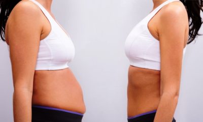 Having Liposuction and a Tummy Tuck at the Same Time