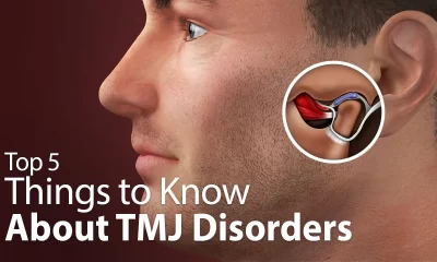Symptoms of TMJ disorder