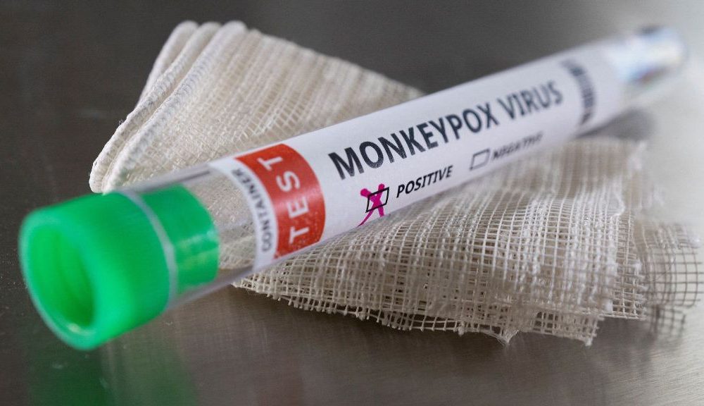 47-Year-Old Gay Man in Bangkok Diagnosed with Monkeypox
