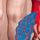 Prevent Deep Vein Thrombosis