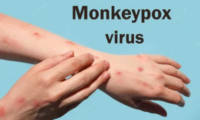 Monkeypox: WHO Calls For 'Urgent' Action