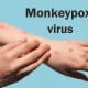 Monkeypox: WHO Calls For 'Urgent' Action