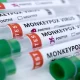 Thailand’s 4th Monkeypox Case Found In Bangkok Woman