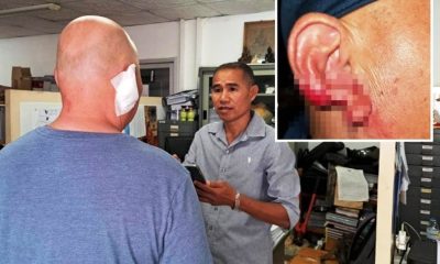 Drunk Woman, 25, BITES Off and SWALLOWS Part of Tourist’s Ear in Pattaya, Thailand