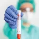 6 People Who Tested Positive For Monkeypox have Died in U.S.