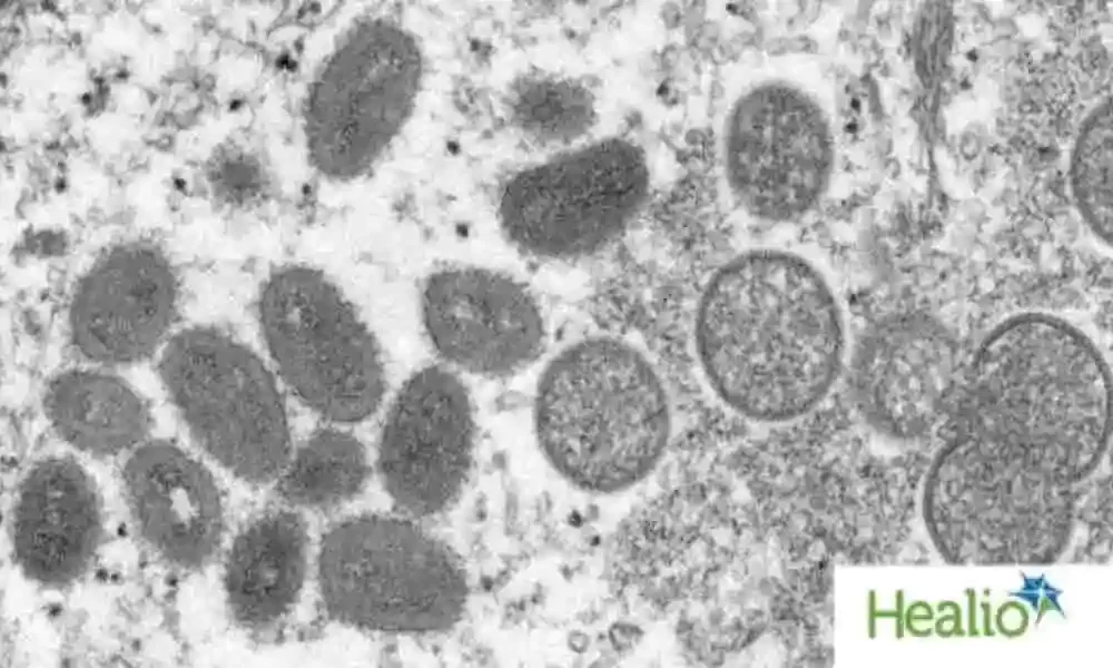 Ocular Monkeypox And Needlestick Infections Reported By The CDC