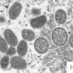 Ocular Monkeypox And Needlestick Infections Reported By The CDC