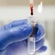 Blood Grown In The Lab Given To Humans In The First-ever Trial Aiming At Combating Rare Diseases