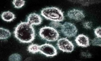 Research: Covid Deteriorates Diabetes Associated Diseases