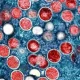 1st Monkeypox Death Confirmed In Indiana