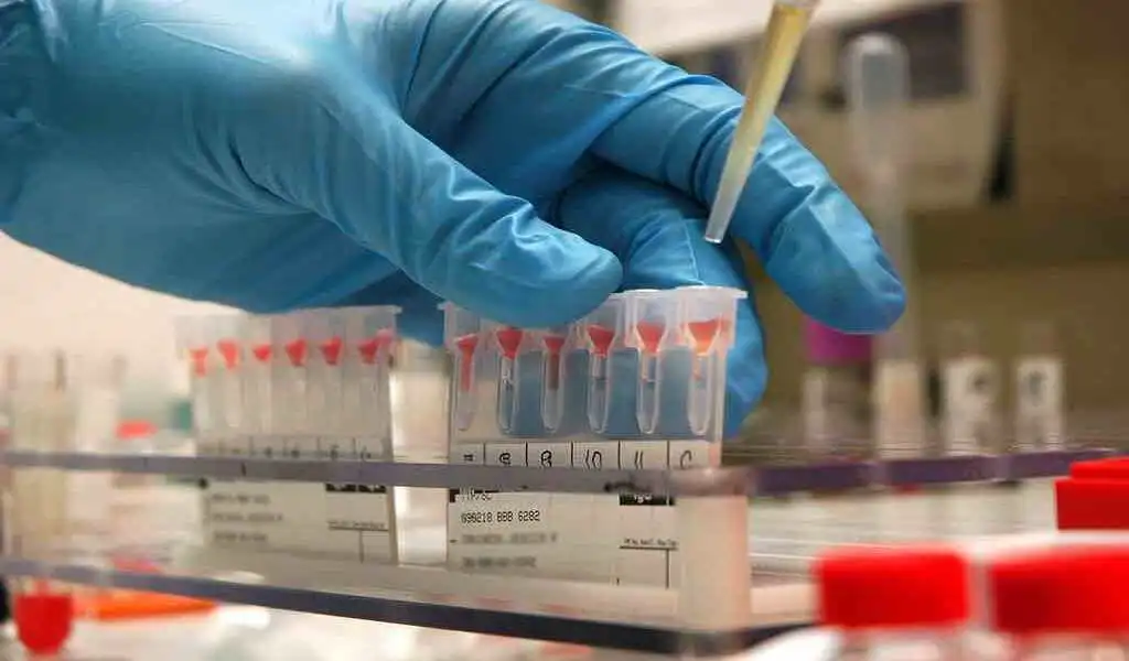 Breast Cancer Could Be Caught 2 Years Earlier With Protein Changes In Blood