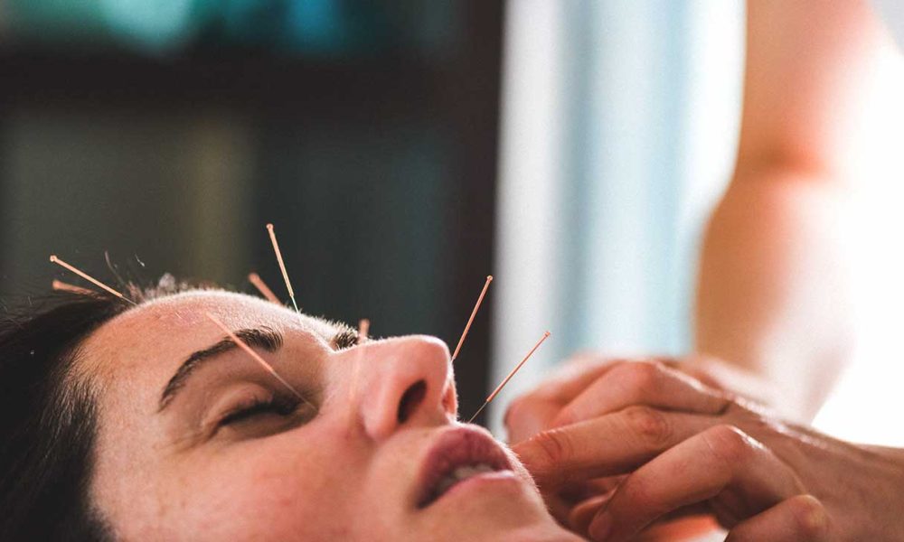 Cosmetic acupuncture
