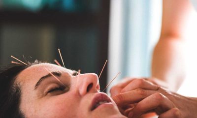 Cosmetic acupuncture