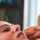 Cosmetic acupuncture