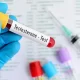 How to Test Your Testosterone Levels