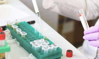 HPV Genotyping Test