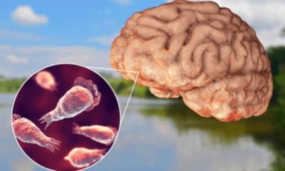 Korean Tourist Dies From Brain Eating Parasite After Thailand Visit
