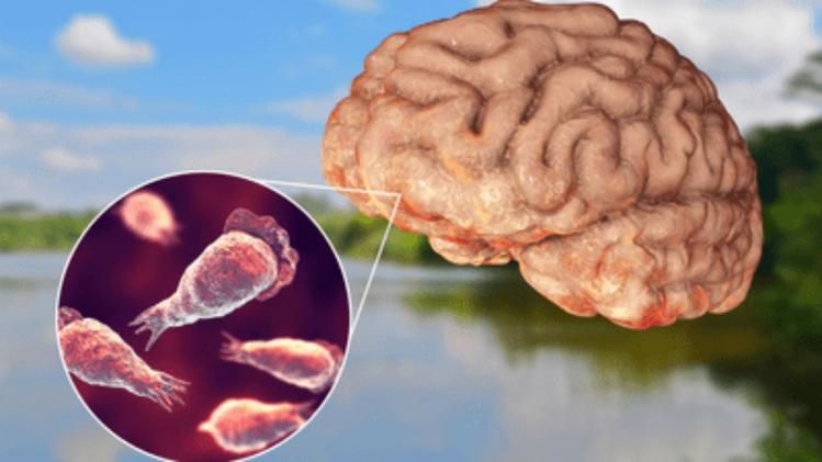 Korean Tourist Dies From Brain Eating Parasite After Thailand Visit