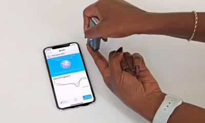 Malaria Detection Using a Life-Saving Light Beam